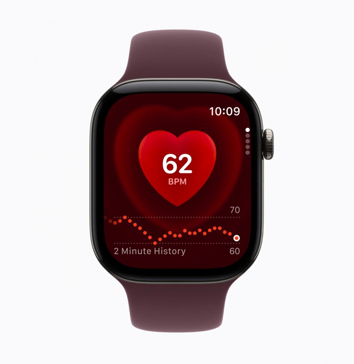 Apple Watch Series 12: S11 chip, új egészségügyi szenzorok és Readiness funkció 2 Watch Series 12