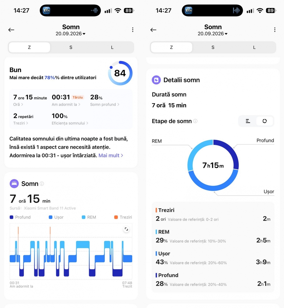 Xiaomi Smart Band 11 Active teszt: van még helye a klasszikus fitneszkarkötőnek 2026-ban? 93 Xiaomi SmartBand 11 Active