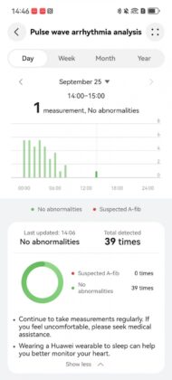 Huawei Watch D3 teszt: vérnyomásmérés sport előtt és után, akár hatnapos üzemidővel