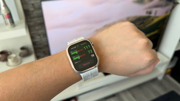 Huawei Watch D3 teszt: vérnyomásmérés sport előtt és után, akár hatnapos üzemidővel